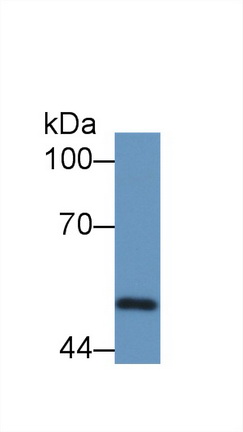 Polyclonal Antibody to Proteasome 26S Subunit, ATPase 4 (PSMC4)