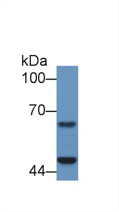 Polyclonal Antibody to Proteasome 26S Subunit, ATPase 4 (PSMC4)