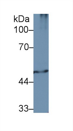 Polyclonal Antibody to Proteasome 26S Subunit, ATPase 2 (PSMC2)