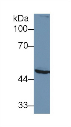 Polyclonal Antibody to Proteasome 26S Subunit, ATPase 2 (PSMC2)