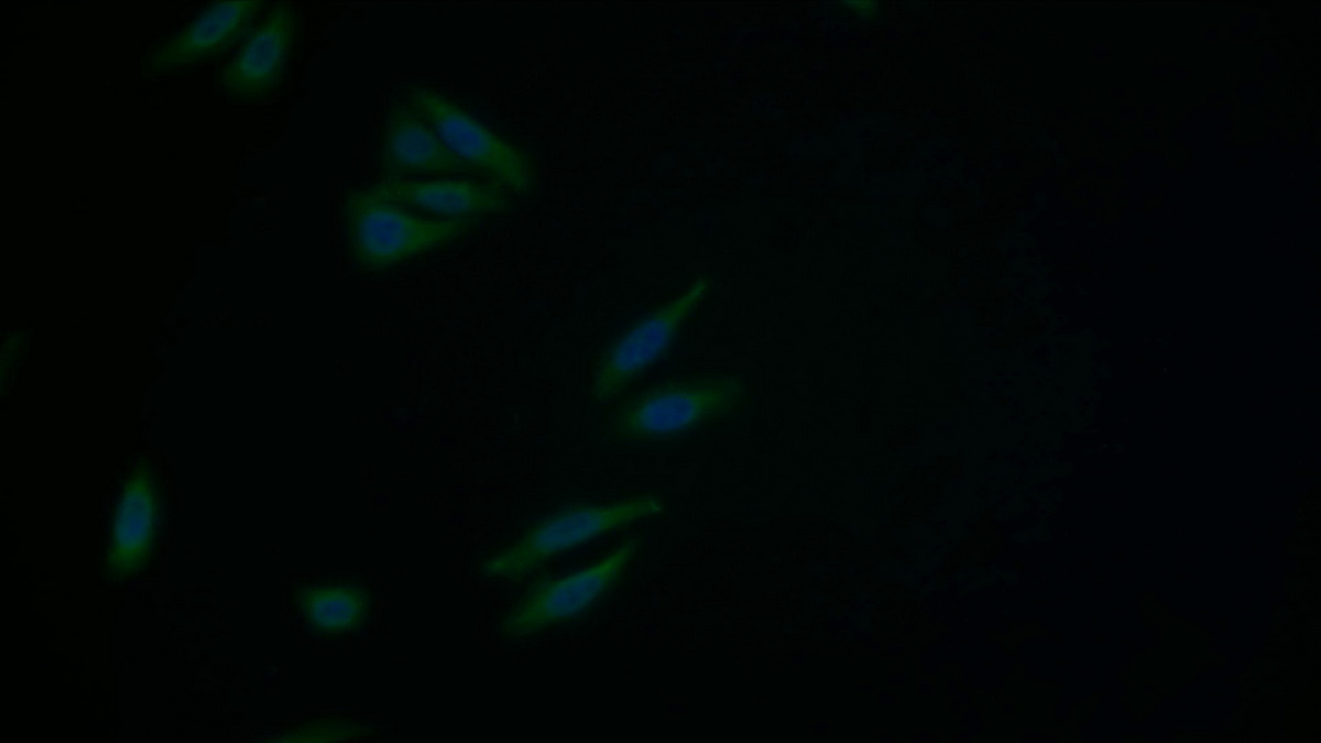 Polyclonal Antibody to Proteasome 26S Subunit, ATPase 3 (PSMC3)