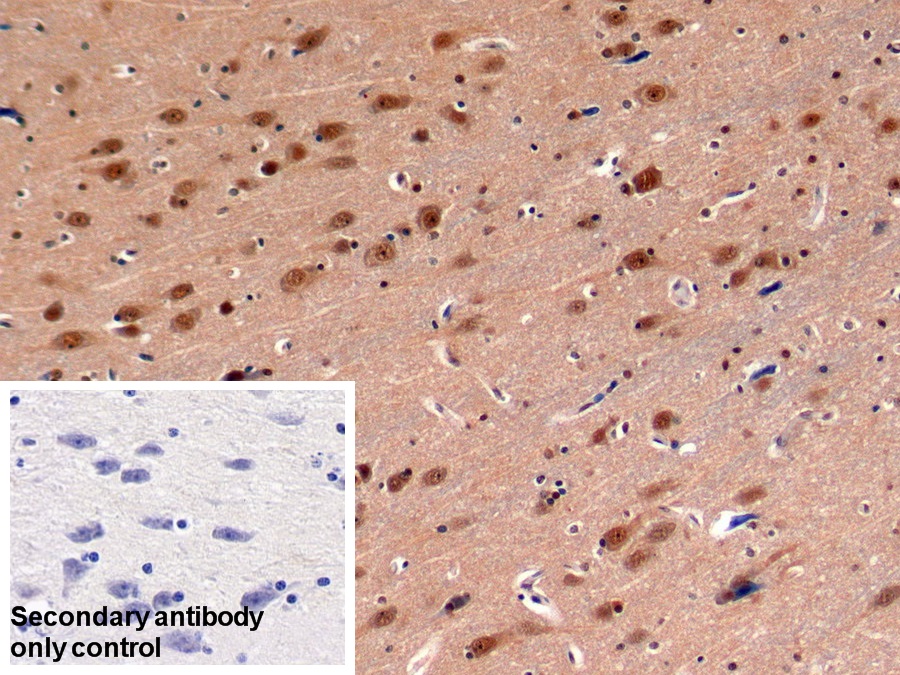 Polyclonal Antibody to Proteasome 26S Subunit, ATPase 3 (PSMC3)