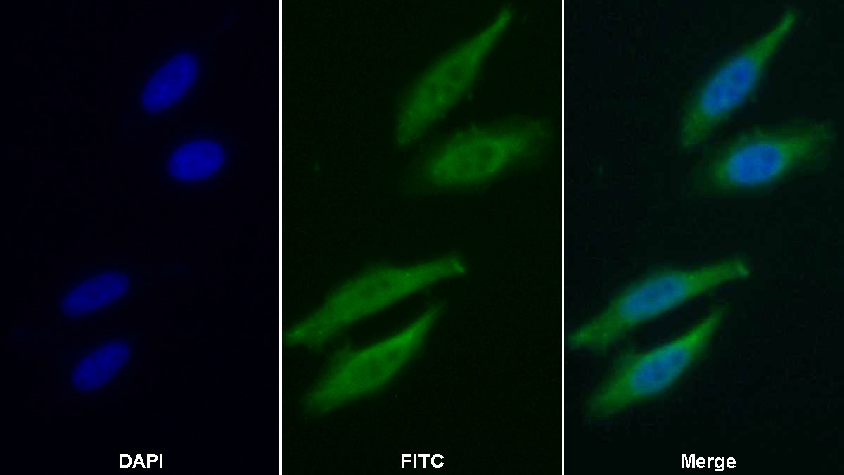 Polyclonal Antibody to Proteasome 26S Subunit, ATPase 3 (PSMC3)