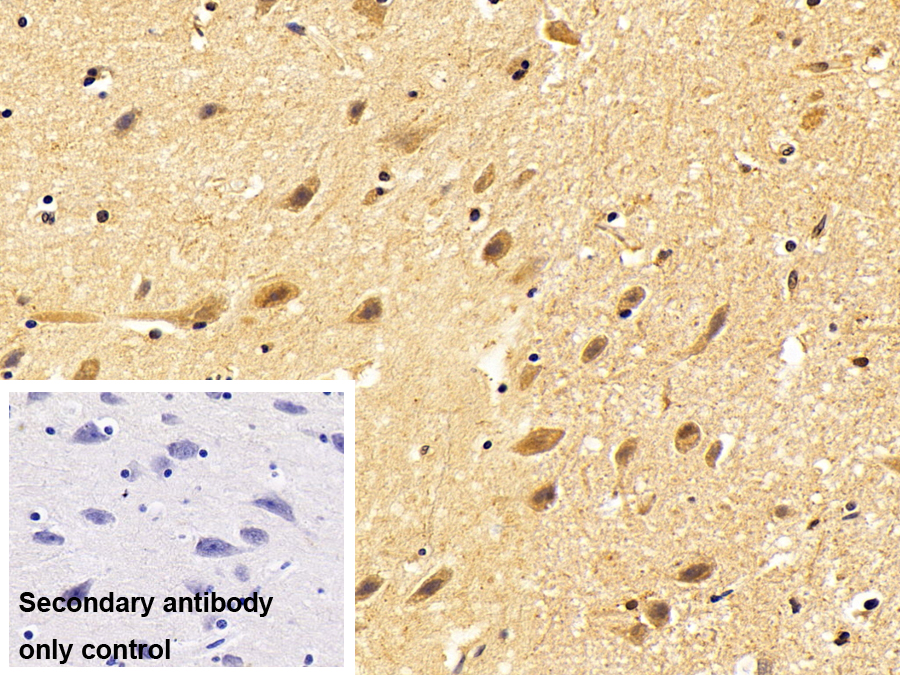 Polyclonal Antibody to Proteasome 26S Subunit, ATPase 3 (PSMC3)