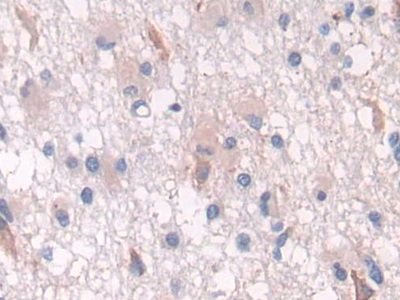 Polyclonal Antibody to Proteasome 26S Subunit, Non ATPase 2 (PSMD2)