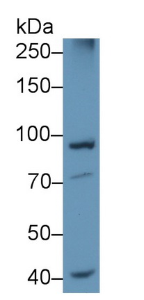 Polyclonal Antibody to Proteasome 26S Subunit, Non ATPase 2 (PSMD2)