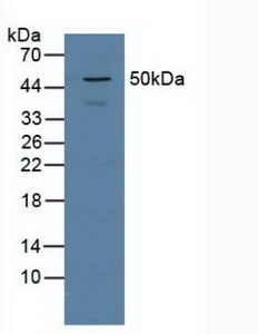 Polyclonal Antibody to Proteasome 26S Subunit, Non ATPase 5 (PSMD5)