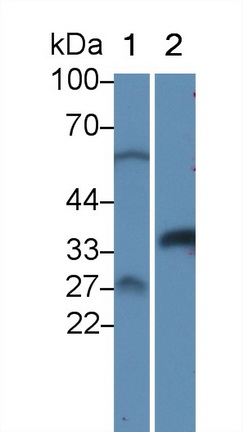 Polyclonal Antibody to Proteasome Activator Subunit 3 (PSME3)