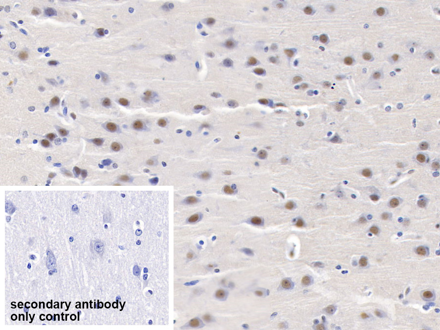 Polyclonal Antibody to Proteasome Activator Subunit 3 (PSME3)