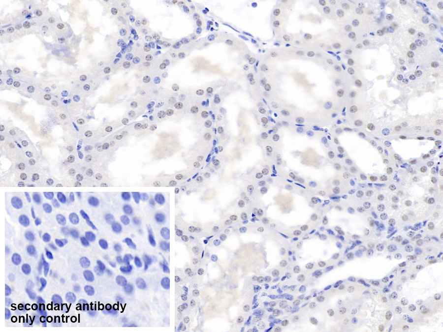 Polyclonal Antibody to Proteasome Activator Subunit 3 (PSME3)