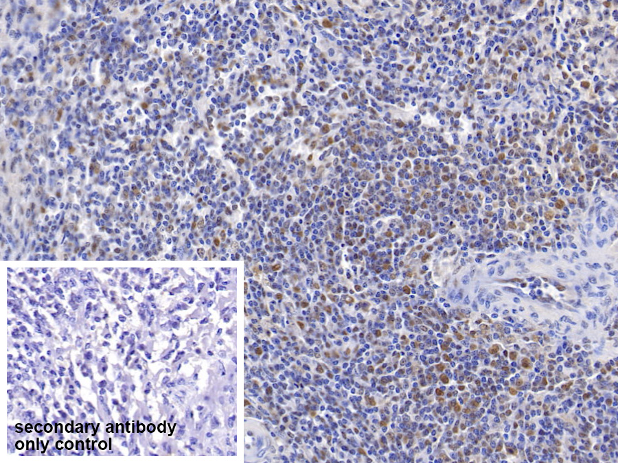 Polyclonal Antibody to Proteasome Activator Subunit 3 (PSME3)