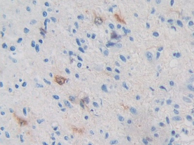 Polyclonal Antibody to Protein Kinase, AMP Activated Beta 2 (PRKAb2)