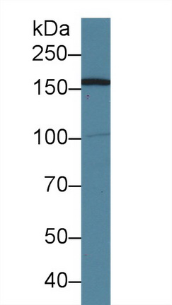 Polyclonal Antibody to Absent In Melanoma 1 (AIM1)