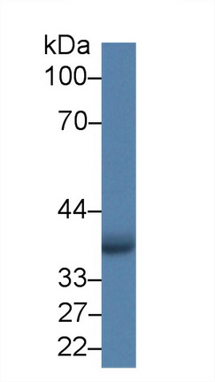 Polyclonal Antibody to Absent In Melanoma 2 (AIM2)