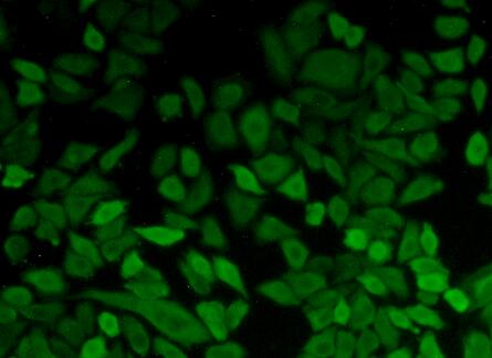 Polyclonal Antibody to Phosphoglycerate Kinase 1 (PGK1)