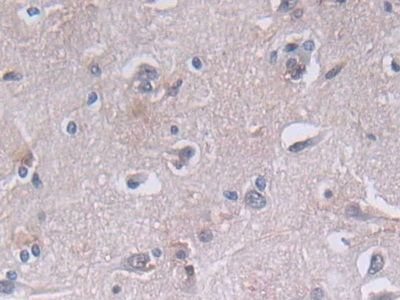 Polyclonal Antibody to Phosphoglycerate Kinase 1 (PGK1)