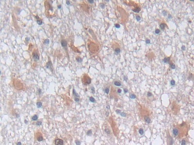 Polyclonal Antibody to Phosphoglycerate Kinase 1 (PGK1)