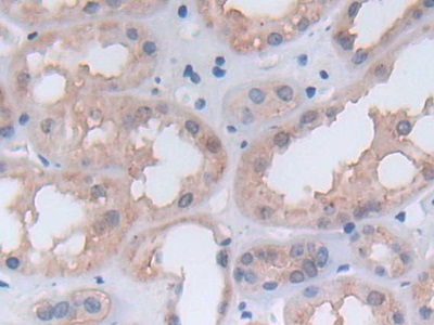 Polyclonal Antibody to Phosphoglycerate Kinase 1 (PGK1)