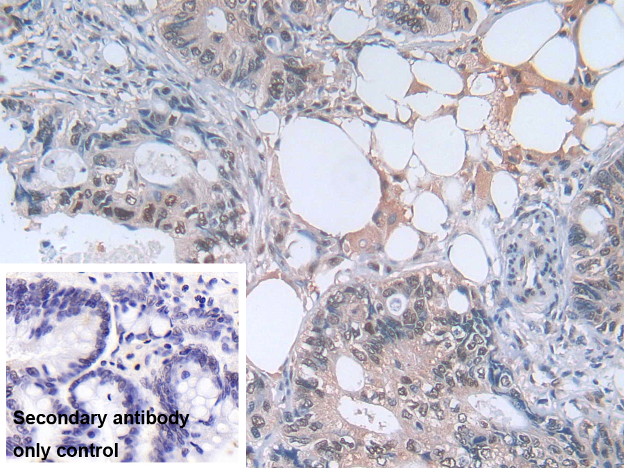 Polyclonal Antibody to Phosphoglycerate Kinase 1 (PGK1)