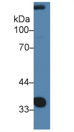 Polyclonal Antibody to Nephroblastoma Overexpressed Gene (NOV)