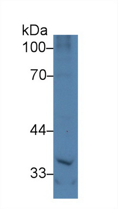 Polyclonal Antibody to Nephroblastoma Overexpressed Gene (NOV)