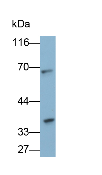 Polyclonal Antibody to Far Upstream Element Binding Protein 3 (FUBP3)