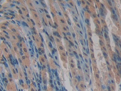 Polyclonal Antibody to Cysteine Rich Protein, Angiogenic Inducer 61 (CYR61)