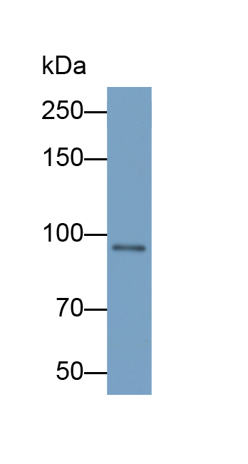 Polyclonal Antibody to Corin (CRN)