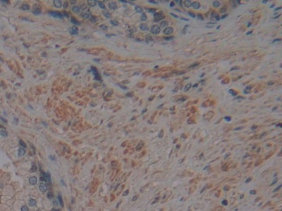 Polyclonal Antibody to Corin (CRN)