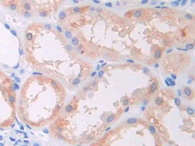 Polyclonal Antibody to Channel Activating Protease 1 (CAP1)