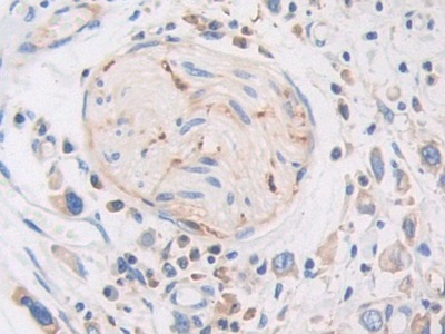 Polyclonal Antibody to Pregnancy Zone Protein (PZP)