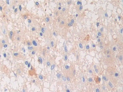 Polyclonal Antibody to Pregnancy Zone Protein (PZP)