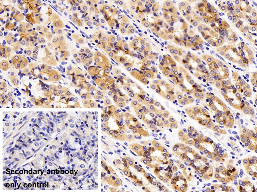 Polyclonal Antibody to Pregnancy Zone Protein (PZP)