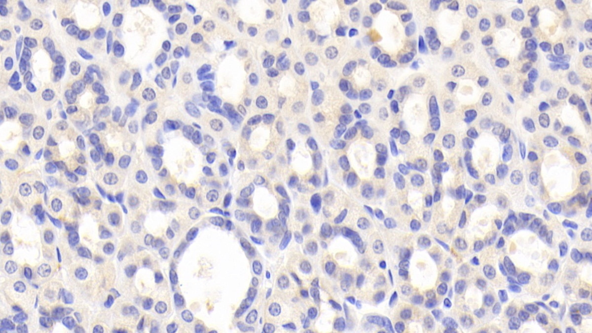 Polyclonal Antibody to Pregnancy Zone Protein (PZP)