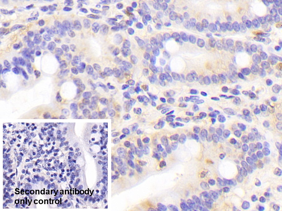 Polyclonal Antibody to Selenium Binding Protein 1 (SELENBP1)