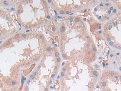 Polyclonal Antibody to Sex Determining Region Y (SRY)