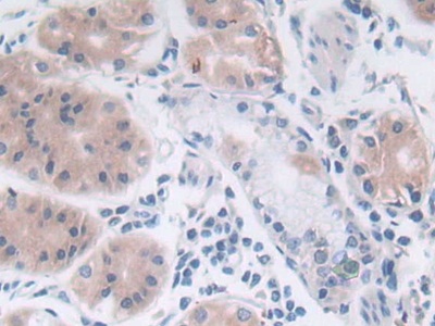 Polyclonal Antibody to Sex Determining Region Y (SRY)