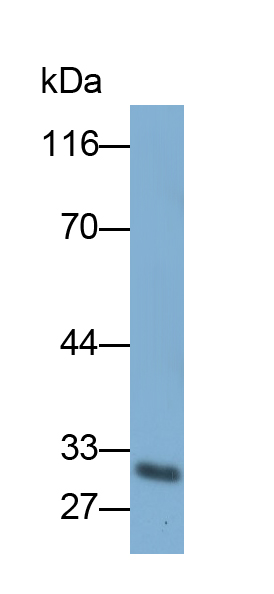 Polyclonal Antibody to 3-Hydroxybutyrate Dehydrogenase 1 (BDH1)