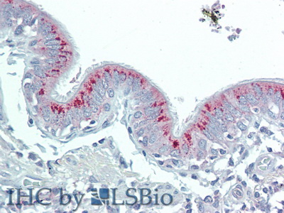 Polyclonal Antibody to Hydroxyacid Oxidase 1 (HAO1)