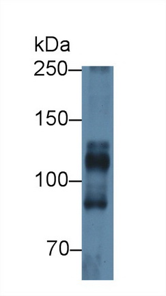 Polyclonal Antibody to ATPase, Na+/K+ Transporting Alpha 1 Polypeptide (ATP1a1)