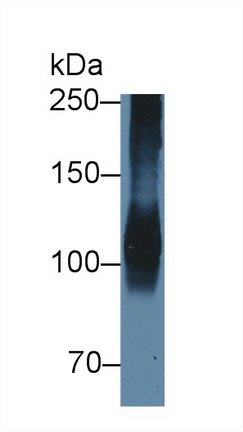 Polyclonal Antibody to ATPase, Na+/K+ Transporting Alpha 1 Polypeptide (ATP1a1)