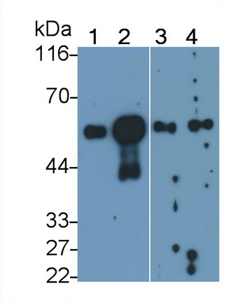 Polyclonal Antibody to ATPase, Na+/K+ Transporting Beta 1 Polypeptide (ATP1b1)