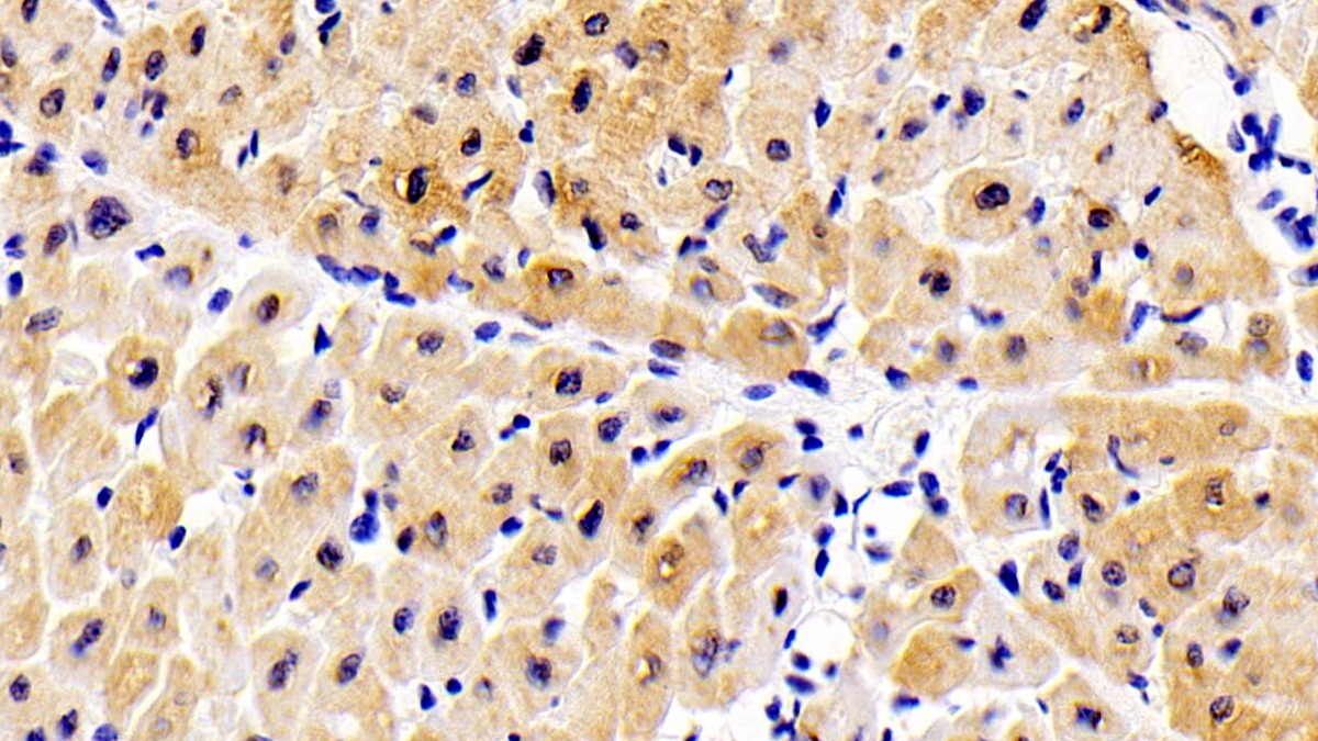 Polyclonal Antibody to ATPase, Ca++ Transporting, Cardiac Muscle, Slow Twitch 2 (ATP2A2)