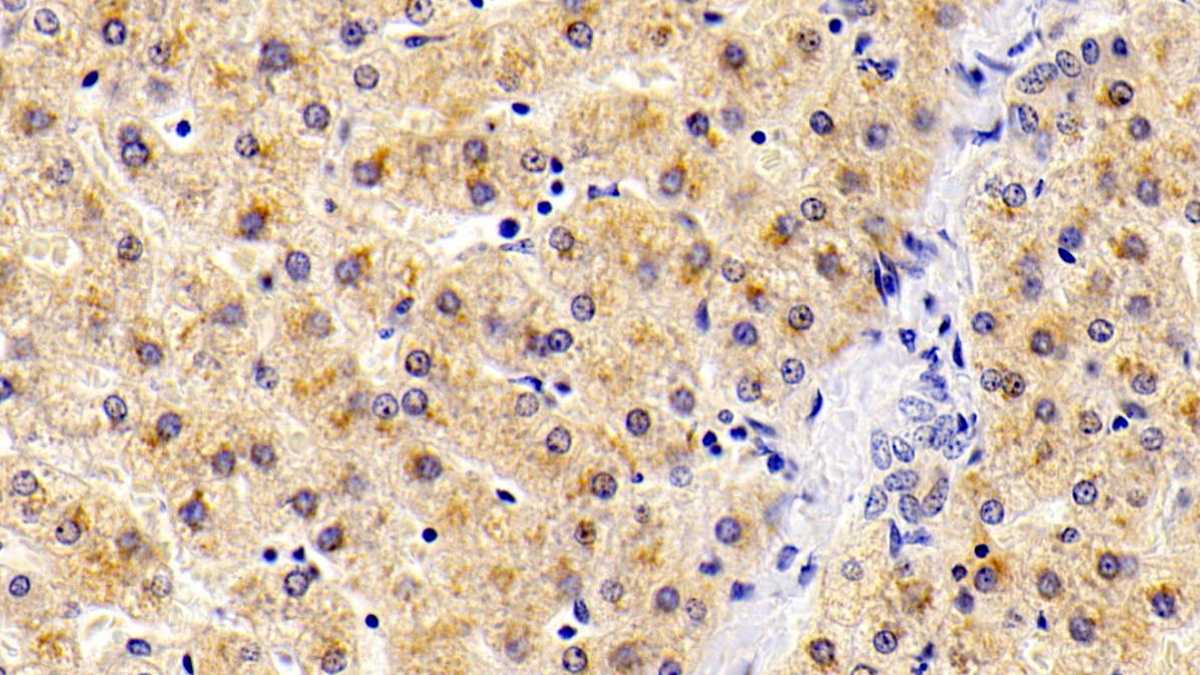 Polyclonal Antibody to ATPase, Ca++ Transporting, Cardiac Muscle, Slow Twitch 2 (ATP2A2)