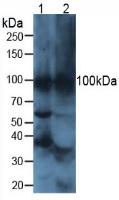 Polyclonal Antibody to ATPase, H+/K+ Exchanging Alpha Polypeptide (ATP4a)