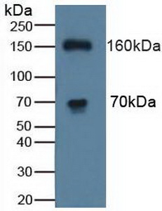 Polyclonal Antibody to ATPase, Cu++ Transporting Beta Polypeptide (ATP7b)