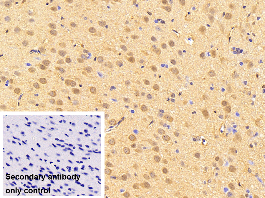 Polyclonal Antibody to ATPase, Cu++ Transporting Beta Polypeptide (ATP7b)