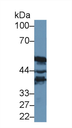 Polyclonal Antibody to ATPase, H+ Transporting, Mitochondrial F1 Complex Beta Polypeptide (ATP5b)