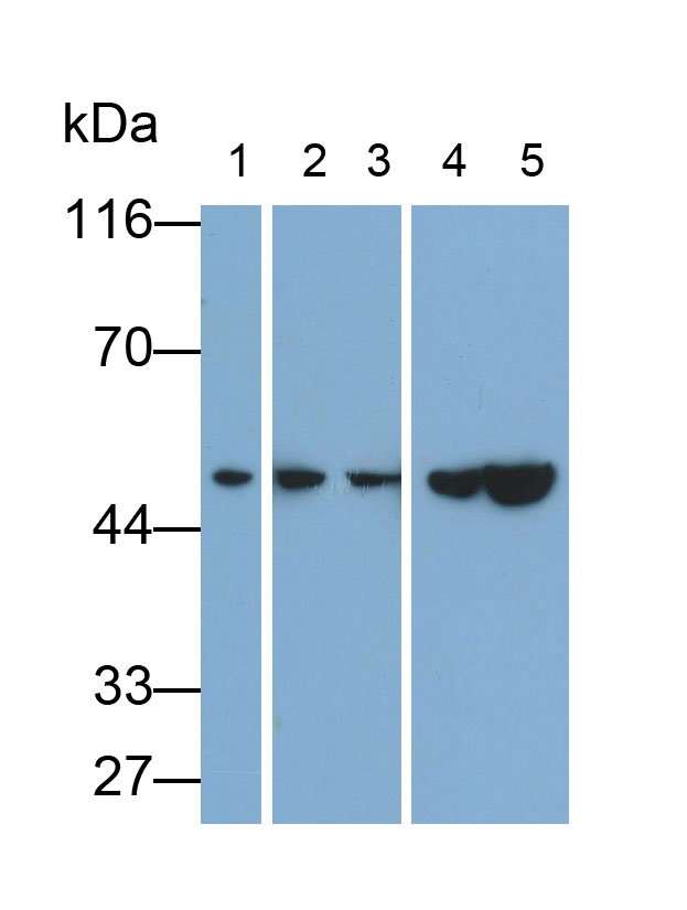 Polyclonal Antibody to ATPase, H+ Transporting, Mitochondrial F1 Complex Beta Polypeptide (ATP5b)