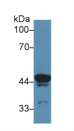 Polyclonal Antibody to ATPase, H+ Transporting, Lysosomal Accessory Protein 2 (ATP6AP2)